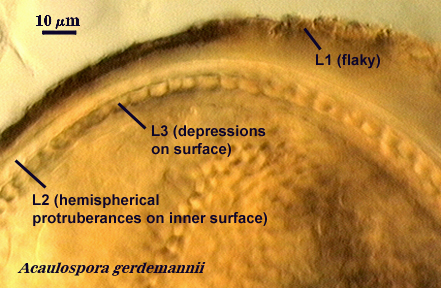 Acaulospora gerdemannii L1, L2 and L3 spore wall