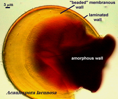 Acaulospora lacunosa beaded membranous laminated spore wall