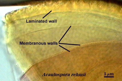 Acaulospora rehmii laminated and membranous spore walls