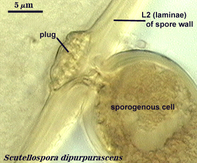 Scutellospora dipurpurascens L2 of spore wall and plug