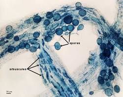 Spores and arbuscules in blue stain