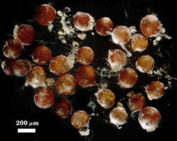 Degraded, dead, or parasitized Dentiscutata heterogama spores photographed at 200 micrometers