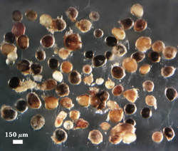 Parasitized or dead Rhizophagus clarus spores photographed at 150 micrometers