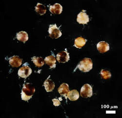 Parasitized or dead spores with black, red, or brown contents shown at 100 micrometer