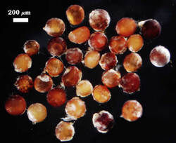 Dentiscutata heterogama spores with patchy contents photographed at 200 micrometers