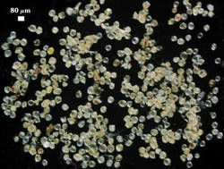 Extracted Diversispora spurca spores photographed at 80 micrometers