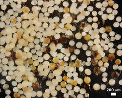 Extracted Gigaspora rosea spores photographed at 200 micrometers