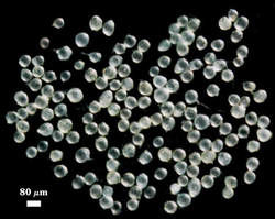 Healthy Diversispora spurca spores photographed at 80 micrometers