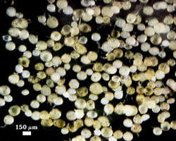 Healthy Rhizophagus clarus spores photographed at 150 micrometers