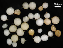 Immature Scutellospora calospora spores photographed at 200 micrometers