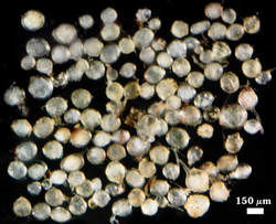 Rhizophagus clarus spores with irregular contents photographed at 150 micrometers