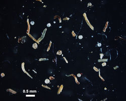 LOW density Ambispora leptoticha photographed at .5mm