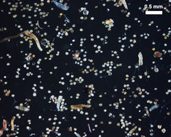 MODERATE density Acaulospora morrowiae photographed at .5mm