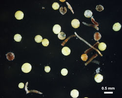 MODERATE density Gigaspora gigantea photographed at .5mm