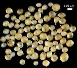 Opaque Rhizophagus clarus spores photographed at 150 micrometers