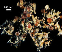 The problem with Dentiscutata heterogama roots photographed at 200 micrometers