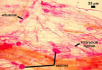 Mycorrhiza stained; labeled where Arbuscules, intraradical hyphae and vesicles are located