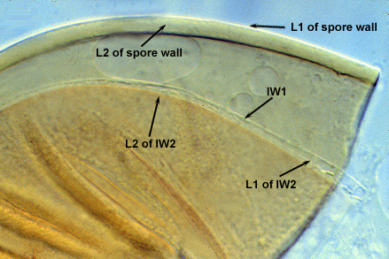 L1 L2 of spore wall iw1 L1 of iw2 L2 of iw2 layers in spore