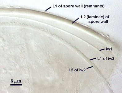 pvlg slide showing rings within remnants of L1 of spore wall the rings going from-outside to inside are L2 of spore wall iw1 L1 of iw2 then L2 of iw2