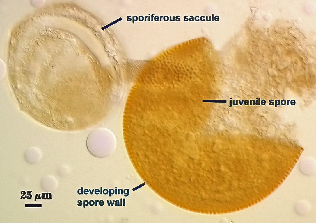 juvenile smashed spore sporiferous sacculle sttemmed smashed sphere