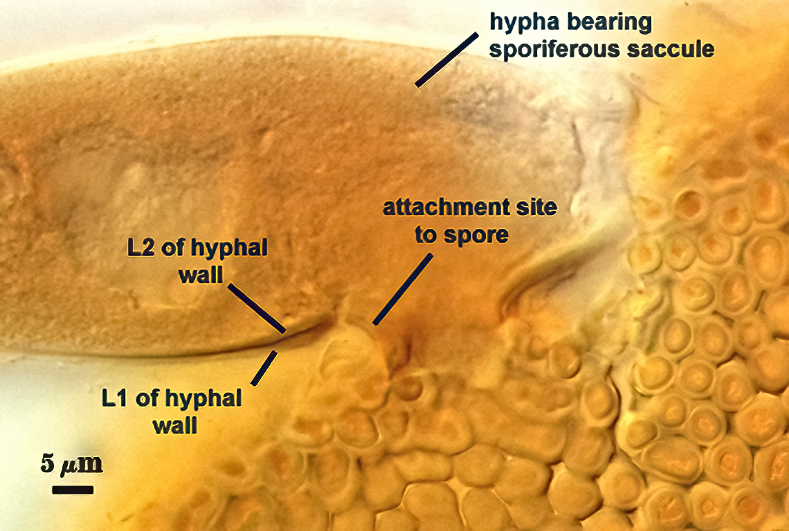 hypha bearing sporifereous sacculle hyphal wall contiguous attatchment to spore