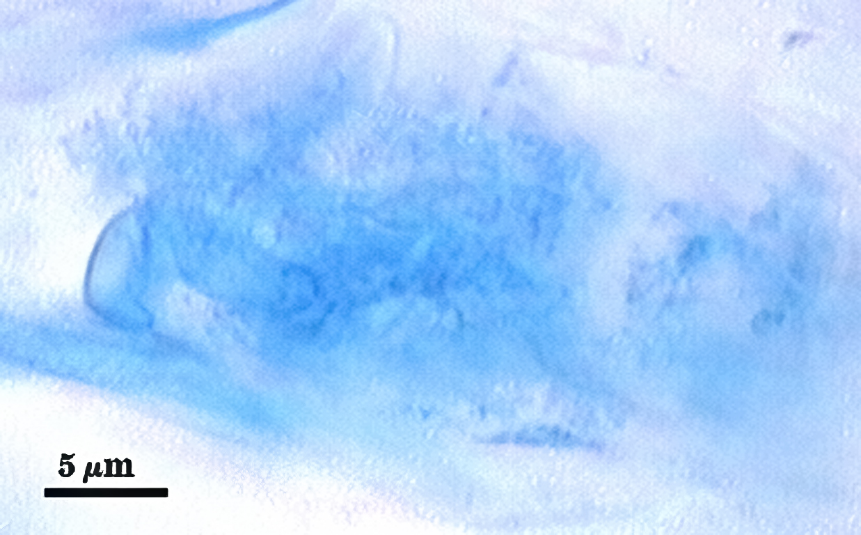 arbuscule faint blue cloud within root cell 2