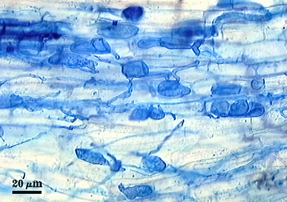 hyphae darker blue oraganic lines between lighter blue root cells