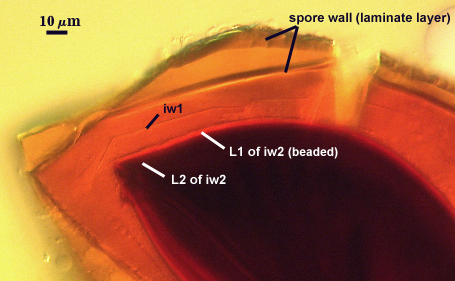 Spore wall laminate layer iw1 L1 beaded of iw2 L2 of iw2