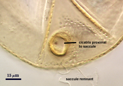 Cicatrix proximal to saccule and saccule remnant
