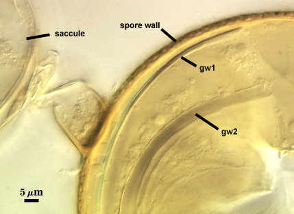 Separated saccule and spore with spore wall gw1 and gw2