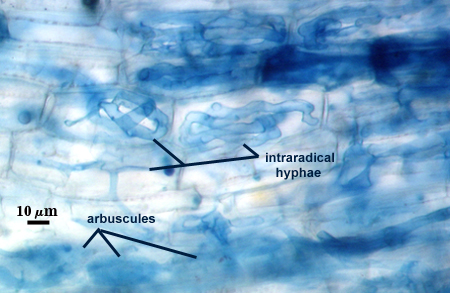 Blue stained roots light blue strings outlined with dark blue intraradical hyphae darker blue clouds representing arbuscules