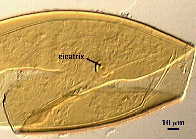 Cicatrix on spore wall