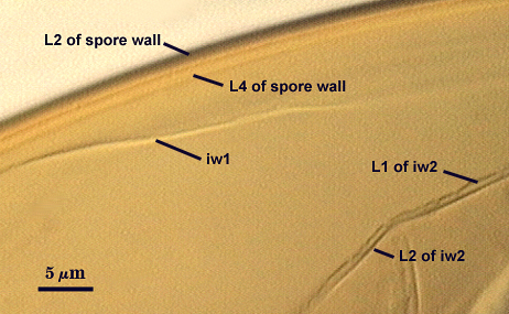 L2 and L4 of spore wall iw1 L1 and L2 of iw2