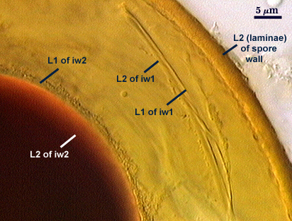 L2 laminae of spore wall L1 and L2 of iw1 L1 and L2 of iw2