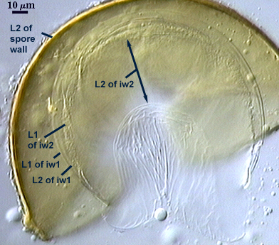 L2 of spore wall L1 and L2 of iw1 L1 and L2 of iw2