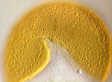 Spore wall with irregular dentations
