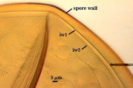Spore wall iw1 and iw2
