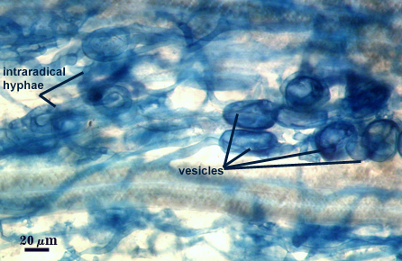 Blue stained roots dark clouds representing arbuscules dark blue sacs representing vesicles blue strings intraradical hyphae