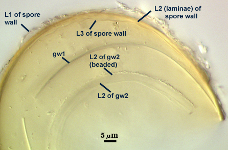 L1 L2 and L3 of spore wall gw1 L2 beaded of gw2