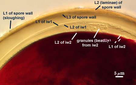 L1 of spore wall sloughing L2 laminae of spore wall L3 of spore wall L1 and L2 of iw1 L1 and L2 of iw2 granules of iw2