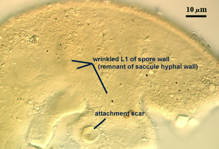 Spore surface with cicatrix