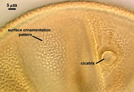 Spore surface with ornamentation pattern with cicatrix