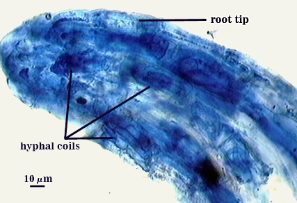 Blue stained root tip dark clouds are hyphal coils