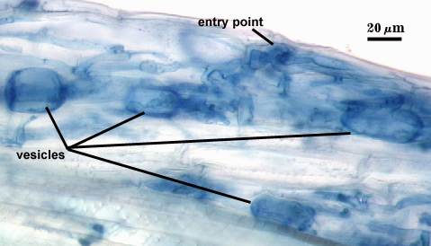 Blue stained roots blue sacs representing vesicles squiggly strings shows entry point