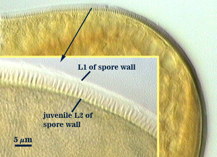 L1 of spore wall juvenile L2 of spore wall ribbed