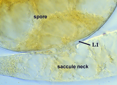 Spore attached to saccule neck