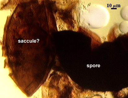 Sporea and saccule 2
