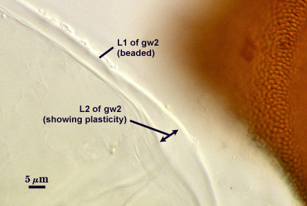 Beaded L1 of gw2 L2 of gw2 showing plasticity