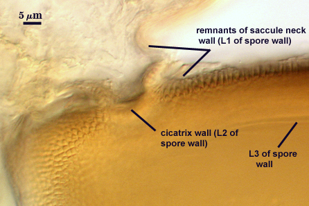 Remnants of saccule neck wall cicatrix wall L3 of spore wall