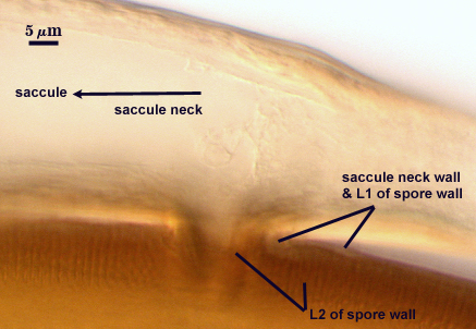 Saccule neck wall, L1 and L2 of spore wall